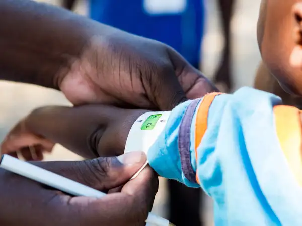 Help diagnose babies and children with malnutrition
